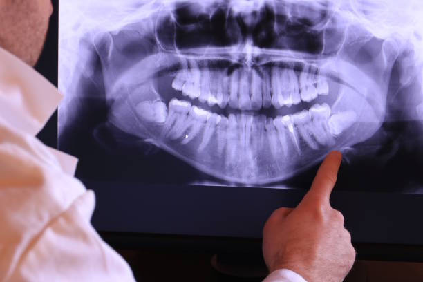 Best Tooth Pain Emergency Relief  in Wilson, AR